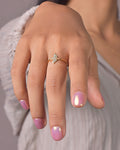 Anillo Circones
